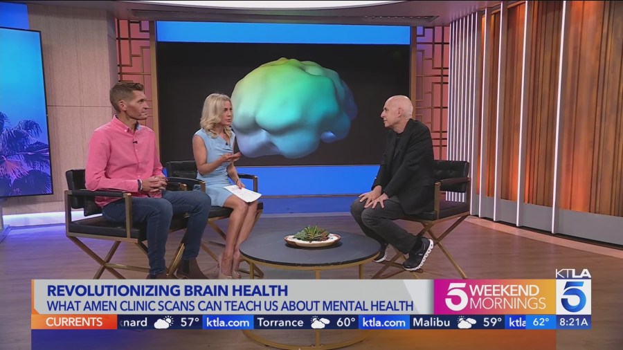 Amen Spect Scan Offers Peek Inside Kacey Montoya S Brain Ktla Amen Spect Scan Offers Peek Inside Kacey Montoya S Brain Ktla